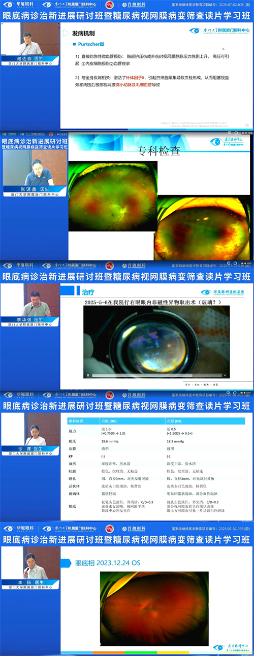 眼底診治新進(jìn)展研討班