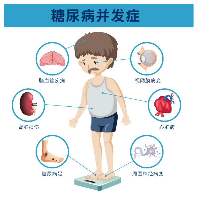 糖尿病視網(wǎng)膜病變